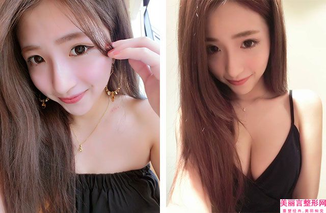 东莞华美整形美容医院正规吗,东莞华美美容是正规医院吗