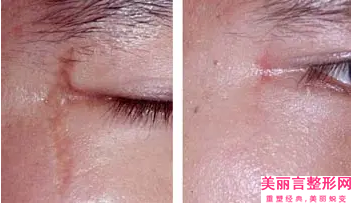 赣州最好的面部轮廓美容医院排名！赣州长安综合医院实力超强
