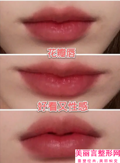 「提醒」广州好的口腔医院排名！前三强口碑测评！