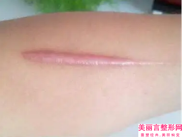 宜宾宜美医学美容整形怎么样(宜宾韩美整形医院)