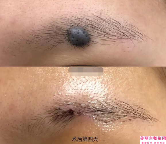 凉山彝族自治州注射肉毒素瘦脸整形医生上榜名单top10详细名单发布-殷秀清医生实力口碑_值得选择