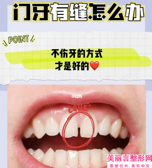 开封影子整形美容医院骨粉填充牙槽骨手术的弊端有哪些