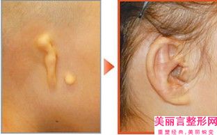 天津市著名耳部轮廓整形医院-天津姝嫣医疗美容门诊入驻榜一