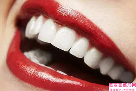 运城丽都医疗美容牙龈肿整形效果能保持多久时间