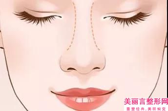 全国鼻畸形整形修复医院哪家好：鼻畸形整形修复医院前50名人气一览