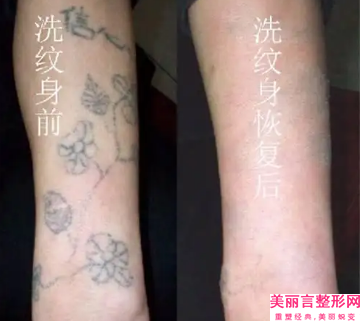 菏泽曹县和平医院,菏泽御美汇医疗美容诊所你更喜欢哪一家