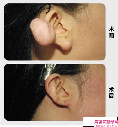 运城丽都整形美容门诊部价目表2024表展示附耳部外观整形案例