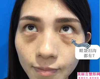 锦州市单眼外斜视矫正价格收费表火热曝光一览-锦州市单眼外斜视矫正价格行情