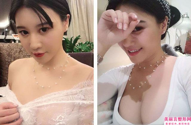 上饶韩美整形医院,上饶鄱阳瑰康医疗美容门诊部二强争霸看你选哪家