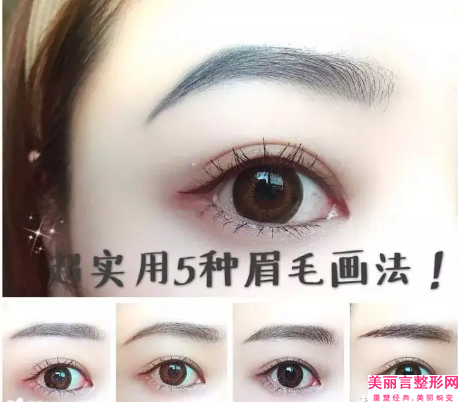 汕头曙光整形美容门诊部收费标准2024公布出炉附开完内眼角案例