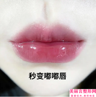 上海茂菊口腔门诊部牙敏感修复多久见效果呢