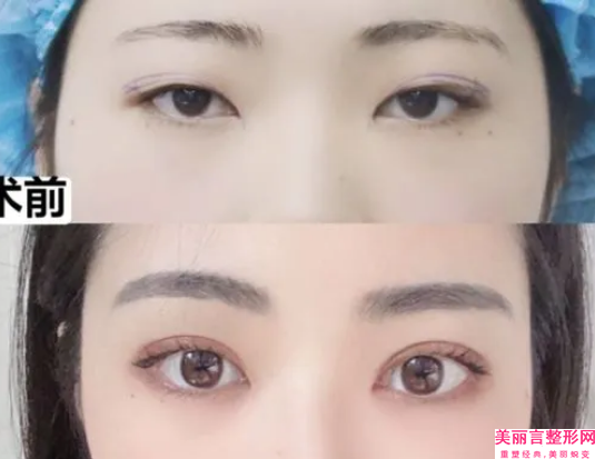 全国近视眼睛修复矫正医院排行榜：近视眼睛修复矫正医院前50如期公布