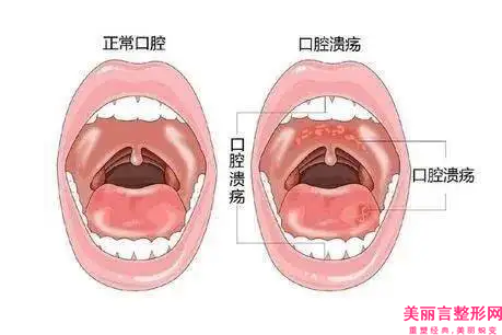 张掖市水光针补水医生上榜清单前十位口碑擅长测评-罗虹霞医生网友热门推荐