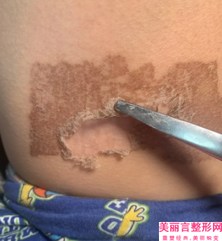 浙江普陀医院,妃斯医疗美容门诊部地址在哪收费价格表