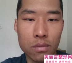 大同曾氏铭仁口腔门诊部价格(收费标准)，近期更新上线-附贴面牙齿案例