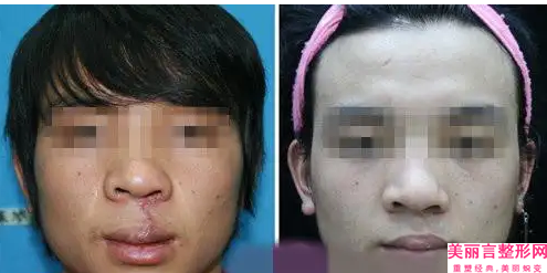 全常州市好的脸上疤痕激光去除医院(常州花泰美医疗美容诊所遍布省内各地)