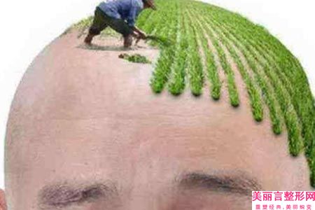 商丘干细胞植发的适合人群以及手术过程