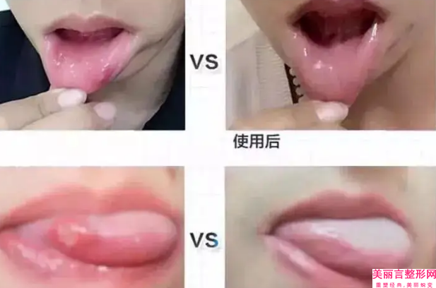 衡水市浅龋医生排行前十位新鲜榜单出炉-衡水市张坤丽口腔医生
