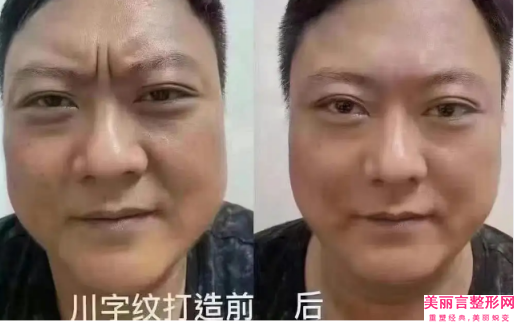 抚顺市快去眼袋医生排名前十位权威名单来啦-赵蕊医生实力测评