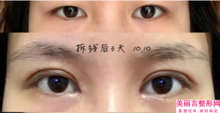 丽江市专业眼部修复医生排名榜top10哪里医（吴吉医生一起来瞧瞧实力高低）