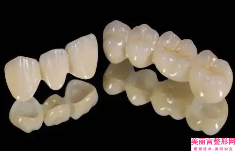 红河门牙缝填充失败修复有副作用吗