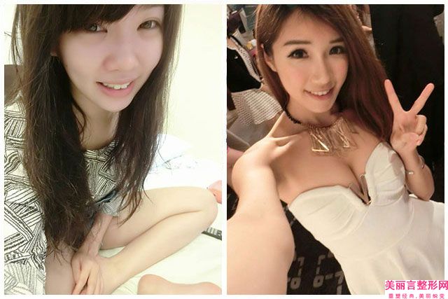 盐城东方整形美容医院,南医大友谊整形盐城门诊人气医生PK
