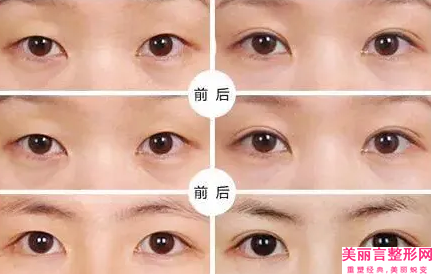 三亚市bodytite射频溶脂瘦脸医生上榜名单前十佳更新了-三亚市bodytite射频溶脂瘦脸医生