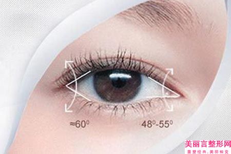 梅州定点双眼皮3d会影响健康吗