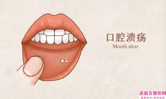 巴音郭楞去唇腭裂手术的伤害大吗
