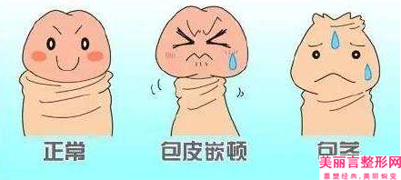 孙杰整形医生-揭阳普宁伊丽莎白整形医疗美容诊所孙杰医师强势推荐