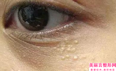 杭州市做面部痉挛手术收费标准2025获取(做面部痉挛手术均价为：70970元)
