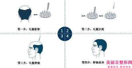 红河州第三人民医院牙齿牙根发黑后该怎么保养好