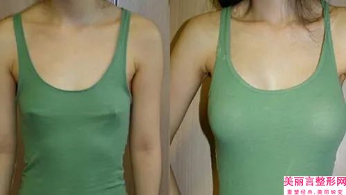 九江学院附属医院整形美容中心乳房整形减肥丰胸的医生哪个更正规