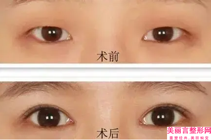 邯郸市男士整形美容医院(河北工程大学附属医院美容整形外科看哪个医生技术好)