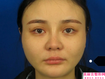 宜宾市活细胞填充脸凹陷医院排名榜前十佳名单表一览（宜宾天使之翼美容整形门诊部整形安全更有保障）