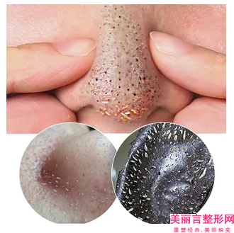 孙玉生医生技术含量高-济南第四人民医院烧伤整形科