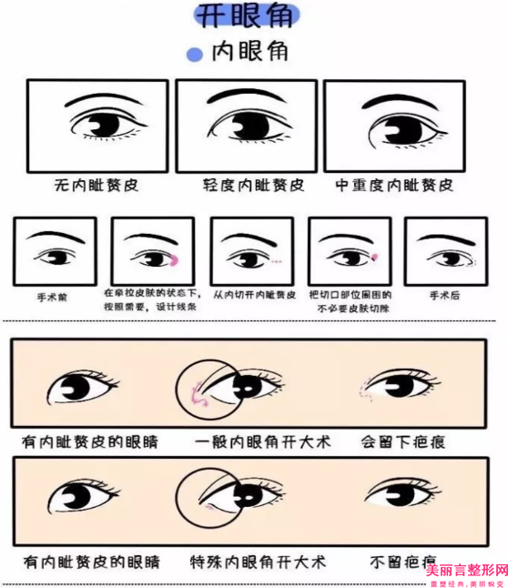 大连医科大学附属第(一)医院整形美容外科李梦颖医生,张晨医生评价效果