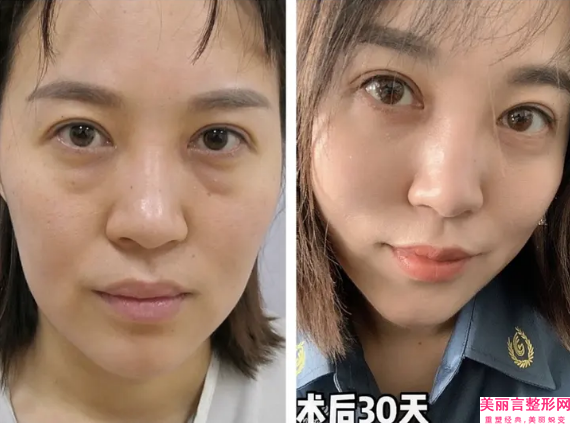 濮阳市脸磨骨价格(2025年濮阳市脸磨骨价格(费用)清单崭新新鲜一览)