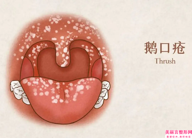 芜湖市好的粘连桥牙齿牙科哪家好-黄晖口腔诊所一起来看看哪些牛