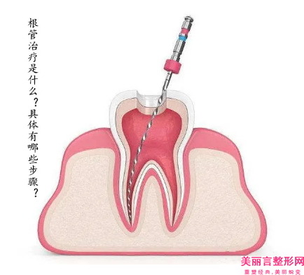 嘉兴市牙齿缺失全瓷牙固定桥多少钱-嘉兴市牙齿缺失全瓷牙固定桥医院排名榜top10权威名单盘点