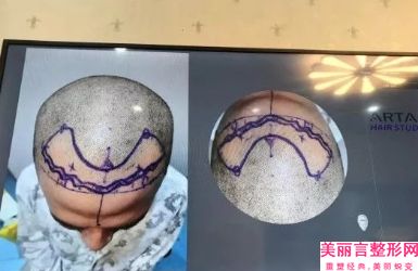 开封第一人民医院价格(收费标准)2025版正式发出-郭敬松医生,张国宪医生介绍