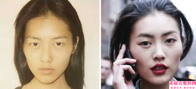 宜宾市专业仿生复合瓷牙贴面医生哪个便宜又好(魏戎医生网友满意度高)