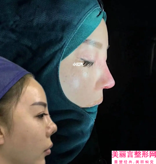 北京市第六医院二部容科到底如何-鼻子畸形修复手术价格大约多少