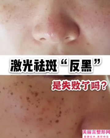 苏州市哪家整形医院专业脸部吸脂减肥好(苏州紫馨整形美容医院好还便宜)