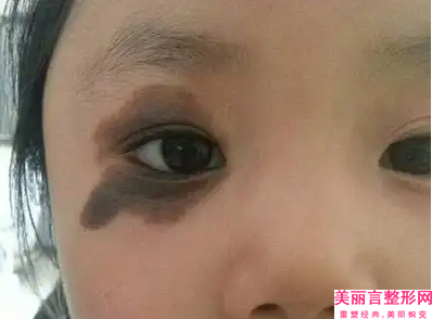 大连第四人民医院医疗整形美容科做抽脂减脸部授权医生名单