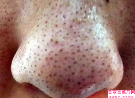 重庆西南医院美容整形外科价格表-整形小腿吸脂价位表公布一份
