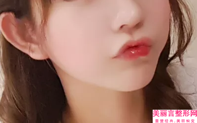 浦东新区成人隐形牙齿矫正医院口腔哪家好-上海东辰口腔门诊部超强口腔攻略