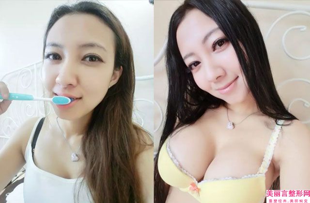 河北工程大学附属医院整形美容科与邯郸市第三医院（邯郸三院）整形美容科你比较看好哪一家