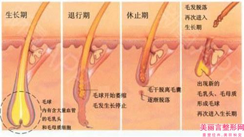 头发移植手术改善效果与植发攻略_植发术怎么施展最佳增发效果