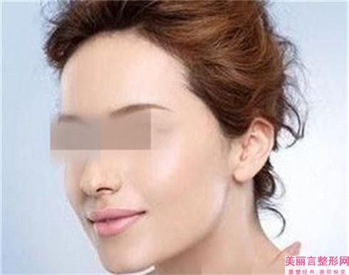 施行副耳去除术以后会有什么副作用吗